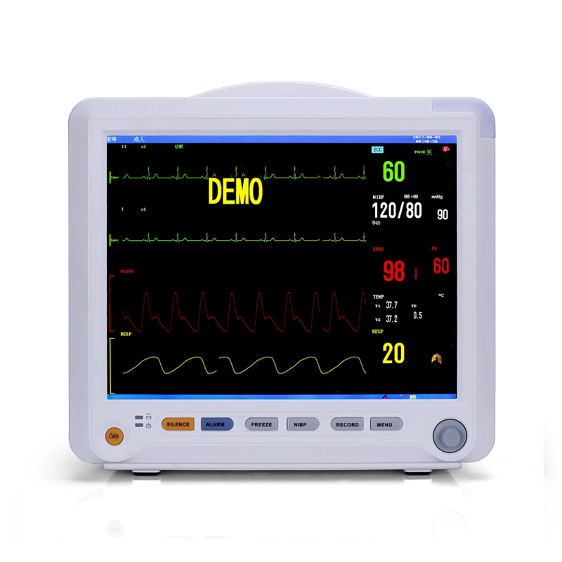 General Ward Tet LCD Color Display 12.1inch Cardiac Monitor ECG Vital Signs ICU Monitor Multi-Parameter Baby Monitor