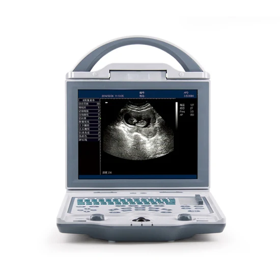 Monitor de ritmo cardíaco de bebé Doppler Fetal con detector de ultrasonido portátil Digital de uso doméstico Prenatal para mujeres